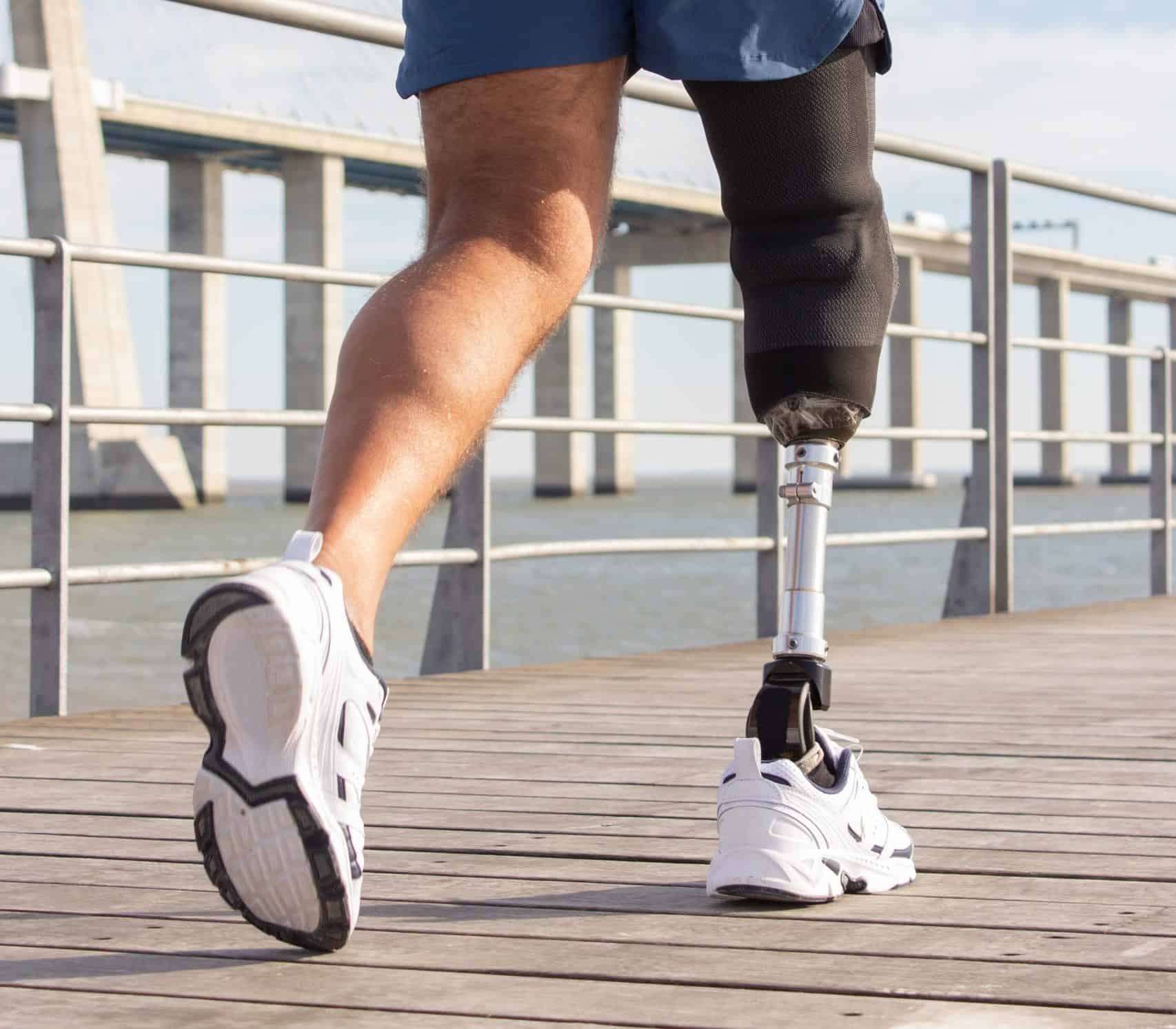 Pr&oacute;tesis para amputados